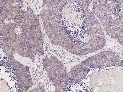 Immunohistochemistry-Paraffin: JNK2 Antibody [NBP2-98812]