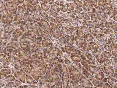 Immunohistochemistry-Paraffin: JNK2 Antibody [NBP2-98812]