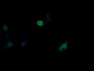 Immunocytochemistry/ Immunofluorescence: JNK2 Antibody (OTI1A1) - Azide and BSA Free [NBP2-71259]