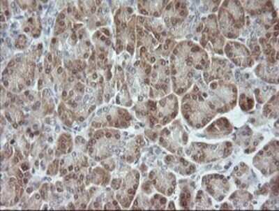 Immunohistochemistry: JNK2 Antibody (OTI1A1) - Azide and BSA Free [NBP2-71259]