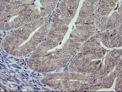 Immunohistochemistry: JNK2 Antibody (OTI1A1) [NBP2-45815]