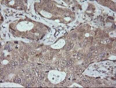 Immunohistochemistry: JNK2 Antibody (OTI1A1) [NBP2-45815]