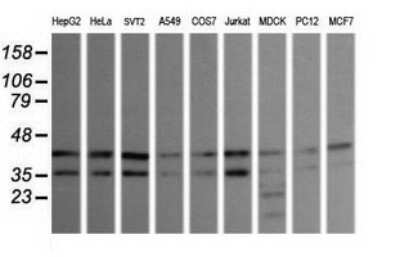 Western Blot: JNK2 Antibody (OTI1A1) [NBP2-45815]