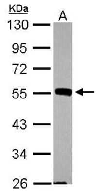 Western Blot: JNK2 Antibody [NBP1-30905]