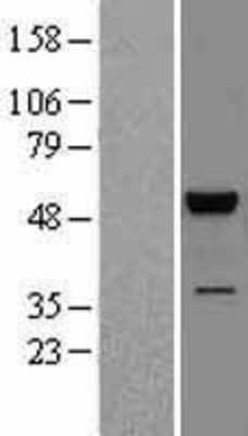 Western Blot: JNK2 Overexpression Lysate [NBL1-12885]