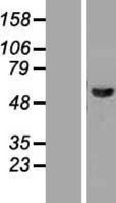 Western Blot: JNK2 Overexpression Lysate [NBP2-05607]