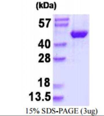 SDS-PAGE: Recombinant Human JNK2 His Protein [NBP1-98883]