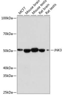 Western Blot: JNK3 Antibody (2O10P2) [NBP3-15649]