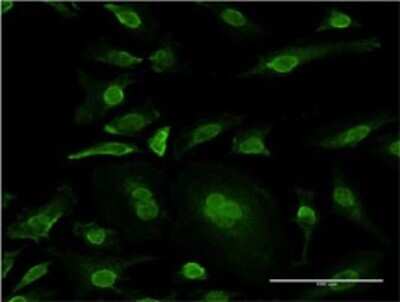 Immunocytochemistry/ Immunofluorescence: JNK3 Antibody (4E12-1F7) [H00005602-M01]