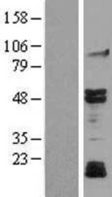 Western Blot: JNK3 Overexpression Lysate [NBL1-12867]