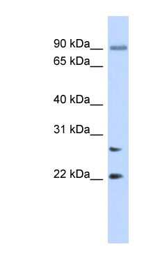 Western Blot: JOSD2 Antibody [NBP1-56709]