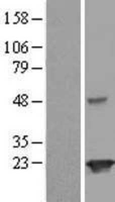 Western Blot: JOSD2 Overexpression Lysate [NBL1-12109]