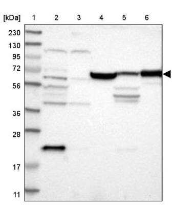 Western Blot: JPH1 Antibody [NBP1-83076]