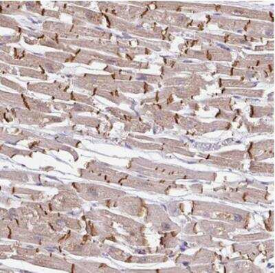 Immunohistochemistry-Paraffin: JPH2 Antibody [NBP2-30961]