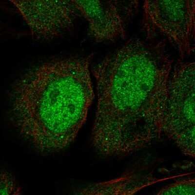 Immunocytochemistry/ Immunofluorescence: JPH3 Antibody [NBP2-56422]