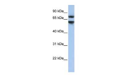 Western Blot: JPH3 Antibody [NBP2-83095]