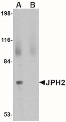 Western Blot: JPH4 AntibodyBSA Free [NBP2-41093]