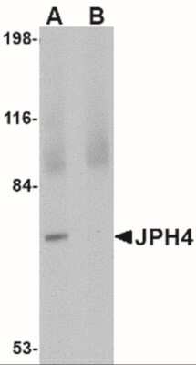 Western Blot: JPH4 AntibodyBSA Free [NBP2-41094]