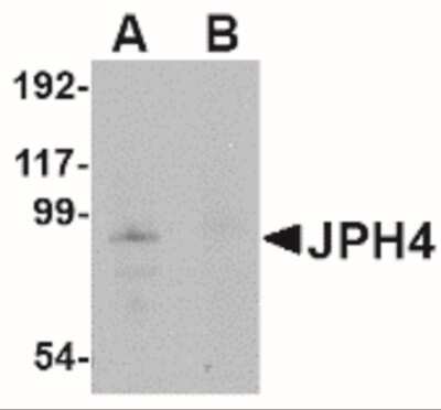 Western Blot: JPH4 AntibodyBSA Free [NBP2-41095]