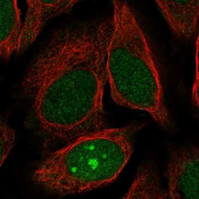 Immunocytochemistry/ Immunofluorescence: JRK Antibody [NBP2-55780]