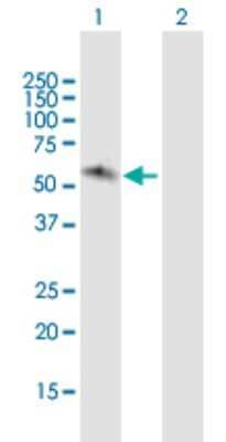 Western Blot: JRK Antibody [H00008629-B01P]