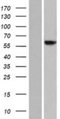 Western Blot: JRK Overexpression Lysate [NBP2-08462]