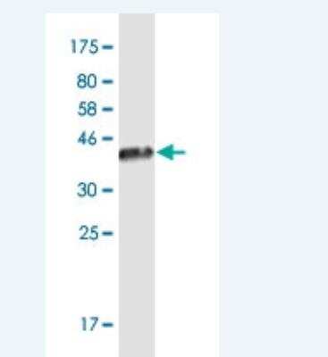 Western Blot: JSRP1 Antibody (6A9) [H00126306-M02-100ug]