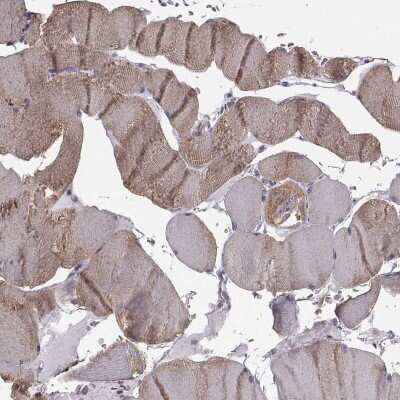 Immunohistochemistry-Paraffin: JSRP1 Antibody [NBP1-81998]