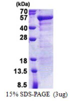 SDS-PAGE: Recombinant Human JSRP1 His Protein [NBP2-23161]