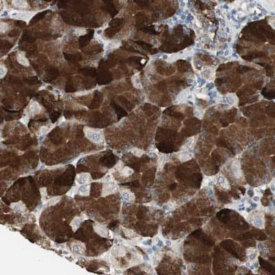 Immunohistochemistry-Paraffin: JTB Antibody [NBP1-81746]