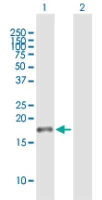 Western Blot: JTB Antibody [H00010899-B01P]