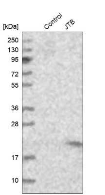 Western Blot: JTB Antibody [NBP1-81746]