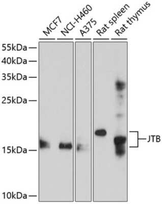 Western Blot: JTB AntibodyBSA Free [NBP3-04953]