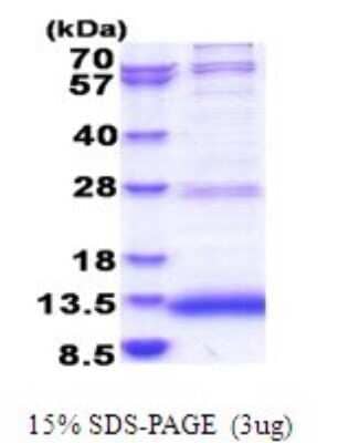 SDS-PAGE: Recombinant Human JTB His Protein [NBP2-51795]