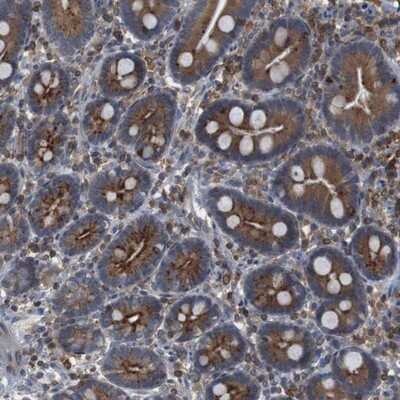 Immunohistochemistry-Paraffin: JWA Antibody [NBP1-84273]