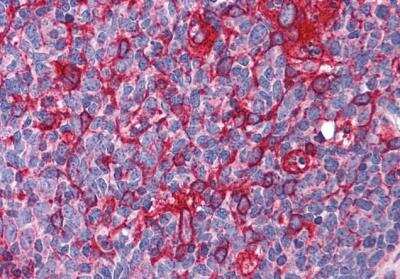 Immunohistochemistry-Paraffin: JWA Antibody [NBP3-12158]