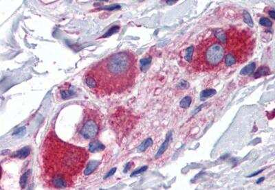 Immunohistochemistry-Paraffin: JWA Antibody [NBP3-12158]
