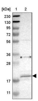 Western Blot: JWA Antibody [NBP1-84273]