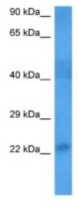 Western Blot: JWA Antibody [NBP3-09996]