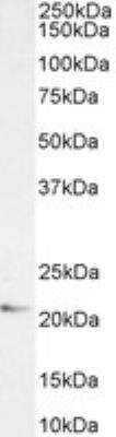 Western Blot: JWA Antibody [NBP3-12158]