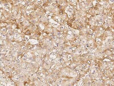Immunohistochemistry: Jade-1/PHF17 Antibody [NBP2-98965]