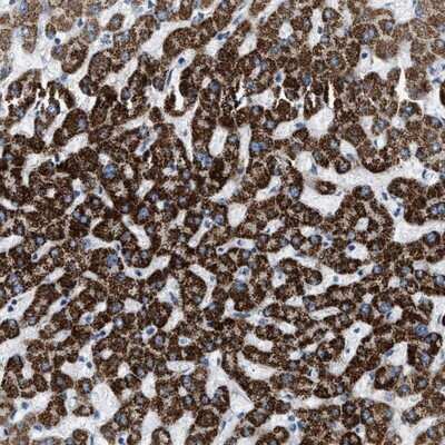 Immunohistochemistry-Paraffin: Jade-1/PHF17 Antibody [NBP1-83085]