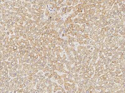 Immunohistochemistry-Paraffin: Jade-1/PHF17 Antibody [NBP2-98965]