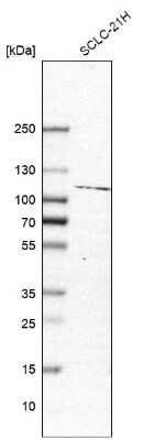 Western Blot: Jade-1/PHF17 Antibody [NBP1-83085]