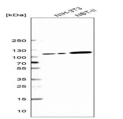 Western Blot: Jade-1/PHF17 Antibody [NBP1-83085]