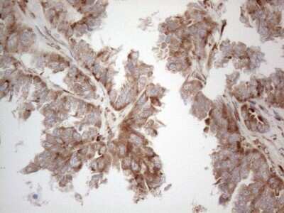 Immunohistochemistry: Jagged 1 Antibody (OTI3A10) [NBP2-45467]