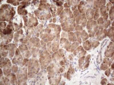 Immunohistochemistry: Jagged 1 Antibody (OTI3A10) [NBP2-45467]