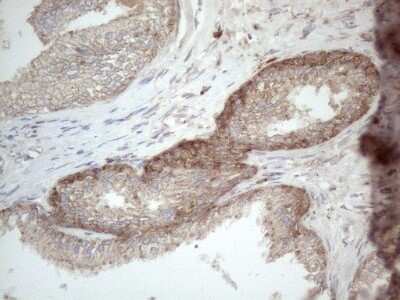 Immunohistochemistry: Jagged 1 Antibody (OTI3A10) [NBP2-45467]