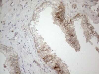 Immunohistochemistry: Jagged 1 Antibody (OTI3A10) [NBP2-45467]