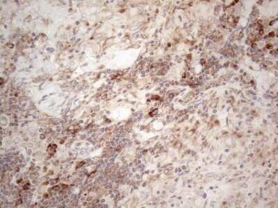 Immunohistochemistry: Jagged 1 Antibody (OTI3A10) [NBP2-45467]